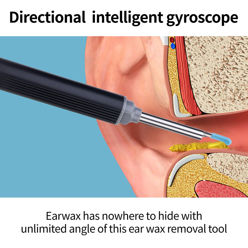 RALYUNI Ear Wax Removal Tool with Camera -Earwax Remover with 8 Pcs Ear Set - Earwax Removal Kit with Light - Ear Cleaner for iOS &Android Black(No delivery on weekends)