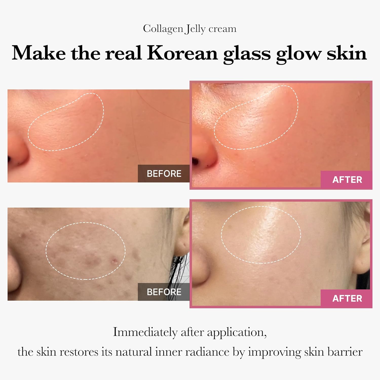 Medicube Collagen Jelly Cream | Niacinamide & Hydrolyzed Collagen | Korean Skincare for 24-Hour Hydration, Glow, & Lifted Look – 3.71 fl. oz.