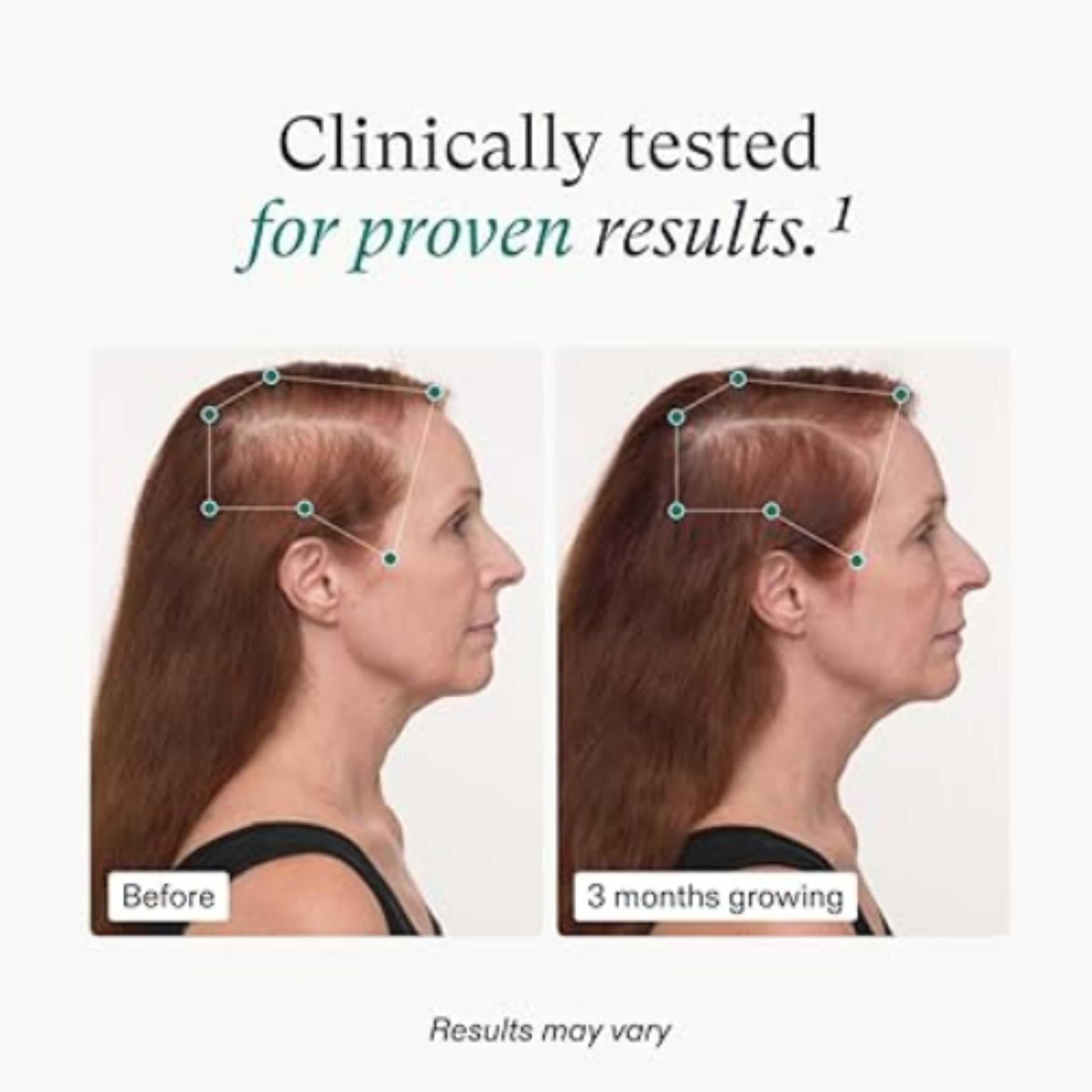 Nutrafol Women’s Balance Hair Growth Gift Pack – Ages 45+ | Clinically Proven for Thicker Hair &amp; Scalp Coverage | Dermatologist Recommended | 1-Month Supply