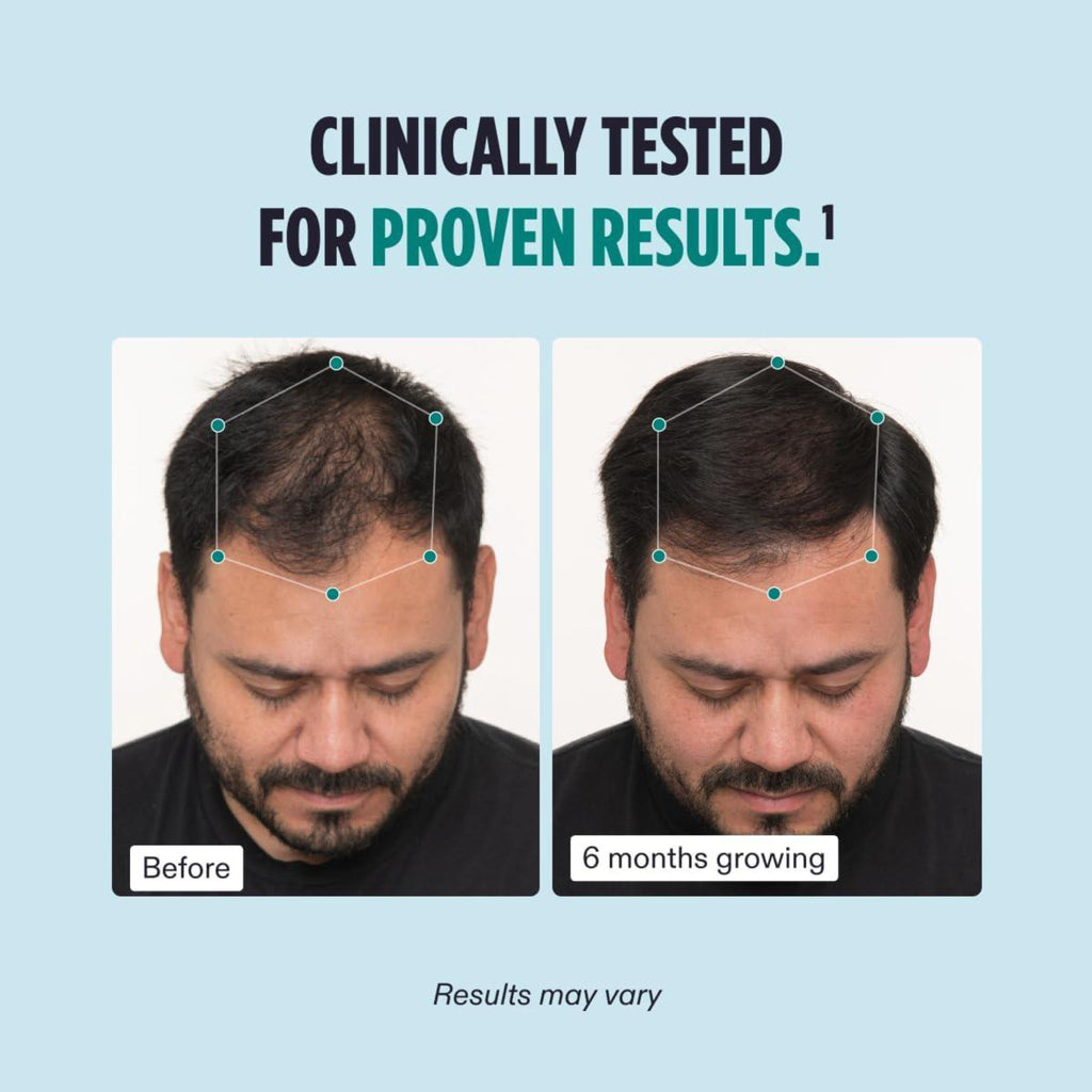 Nutrafol Men’s Hair Growth Supplement – 2 Pack (2-Month Supply)